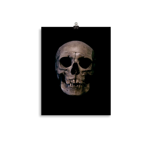 Human skull medical specimen front view - Art print