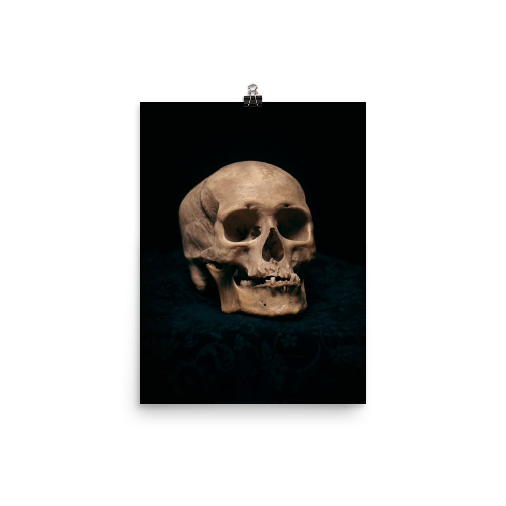 Skull with skewed jaw, real human skull photography - Art print