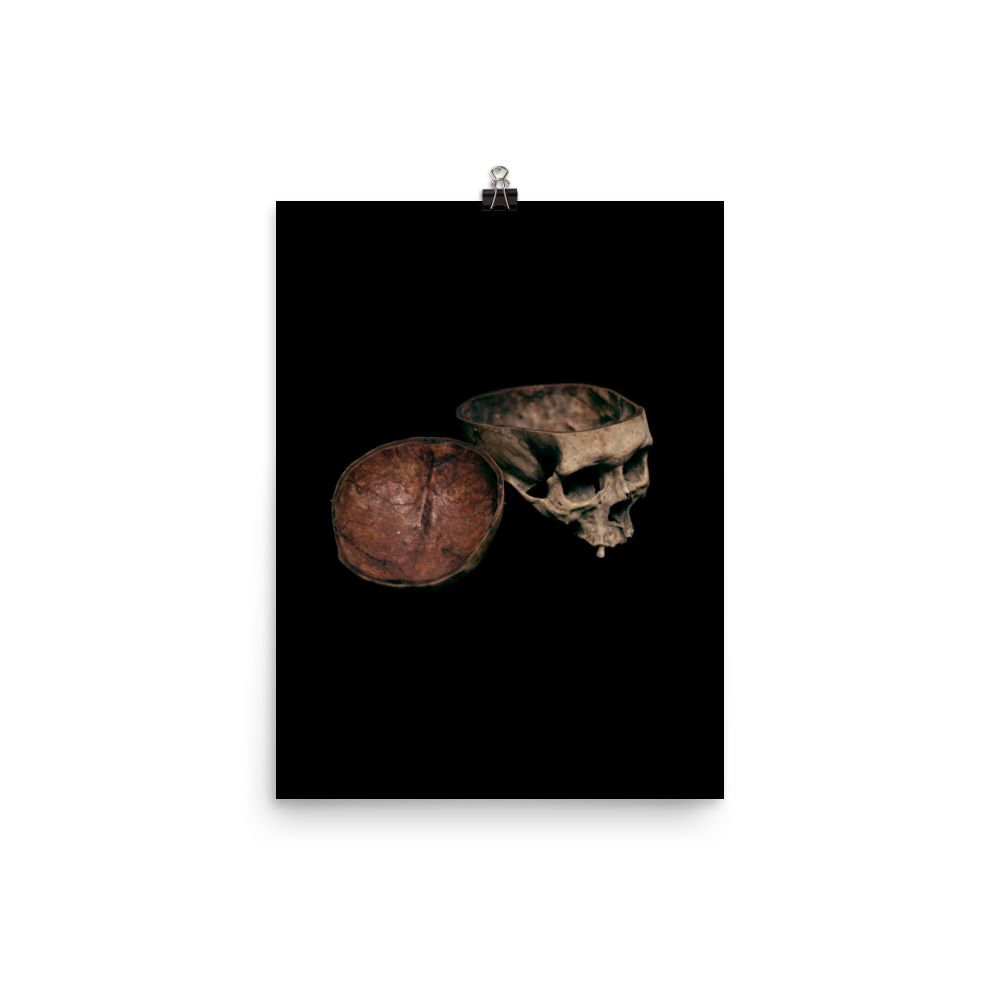 Skull with cut calvarium, real human skull photography - Art print