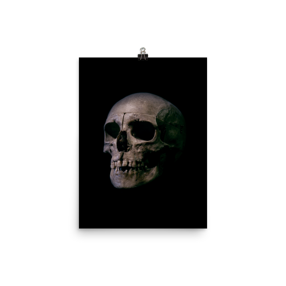 Human skull medical specimen side view - Art print