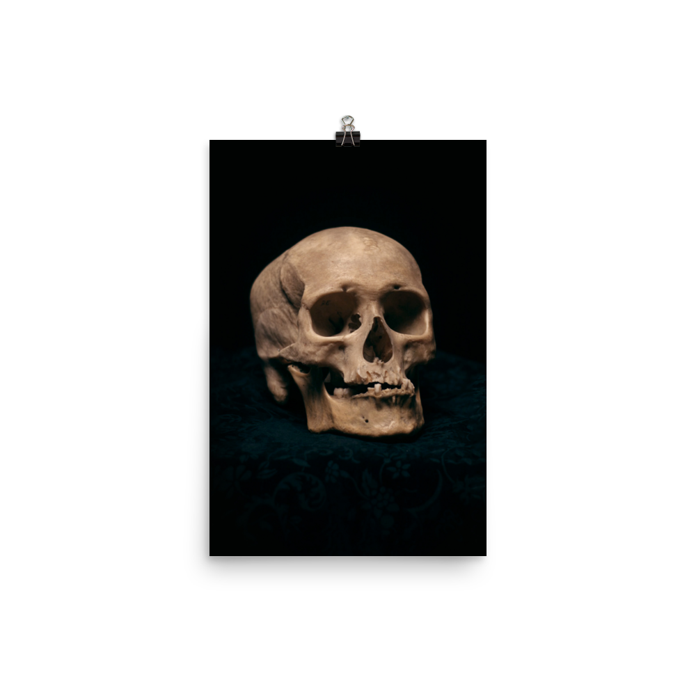 Skull with skewed jaw, real human skull photography - Art print