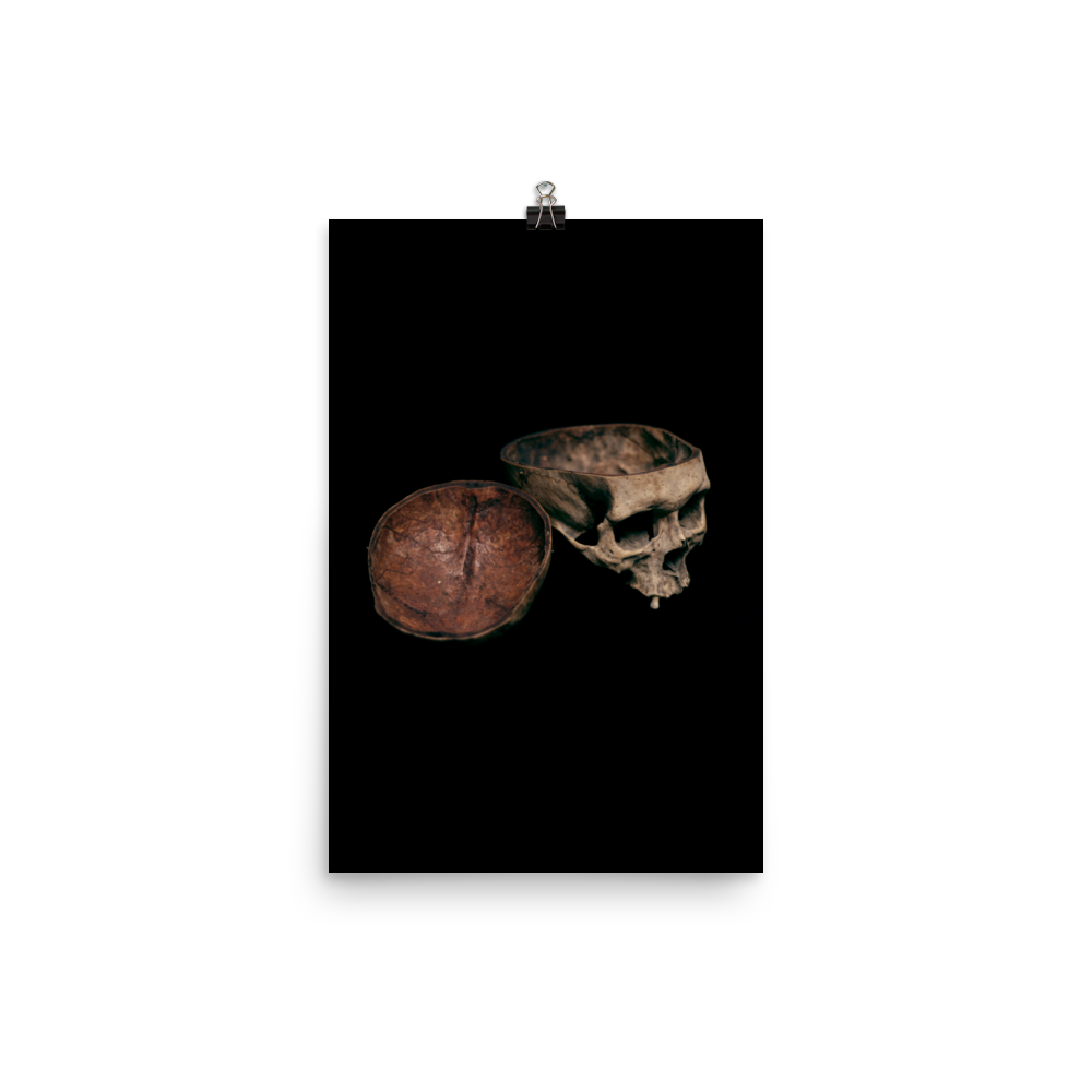 Skull with cut calvarium, real human skull photography - Art print