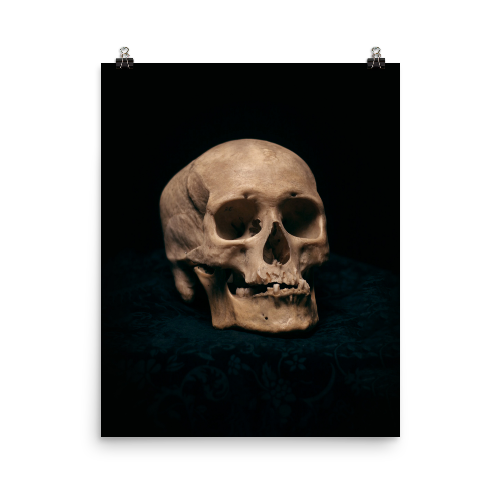 Skull with skewed jaw, real human skull photography - Art print