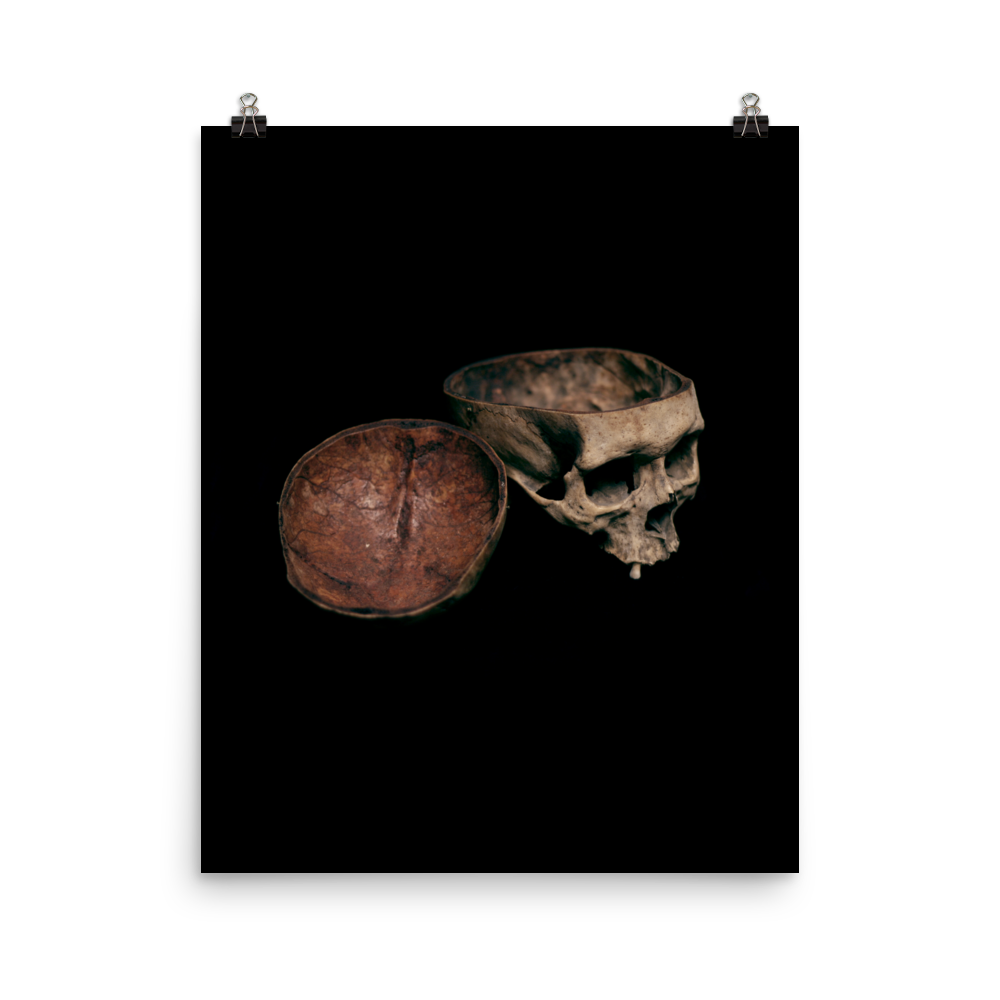 Skull with cut calvarium, real human skull photography - Art print