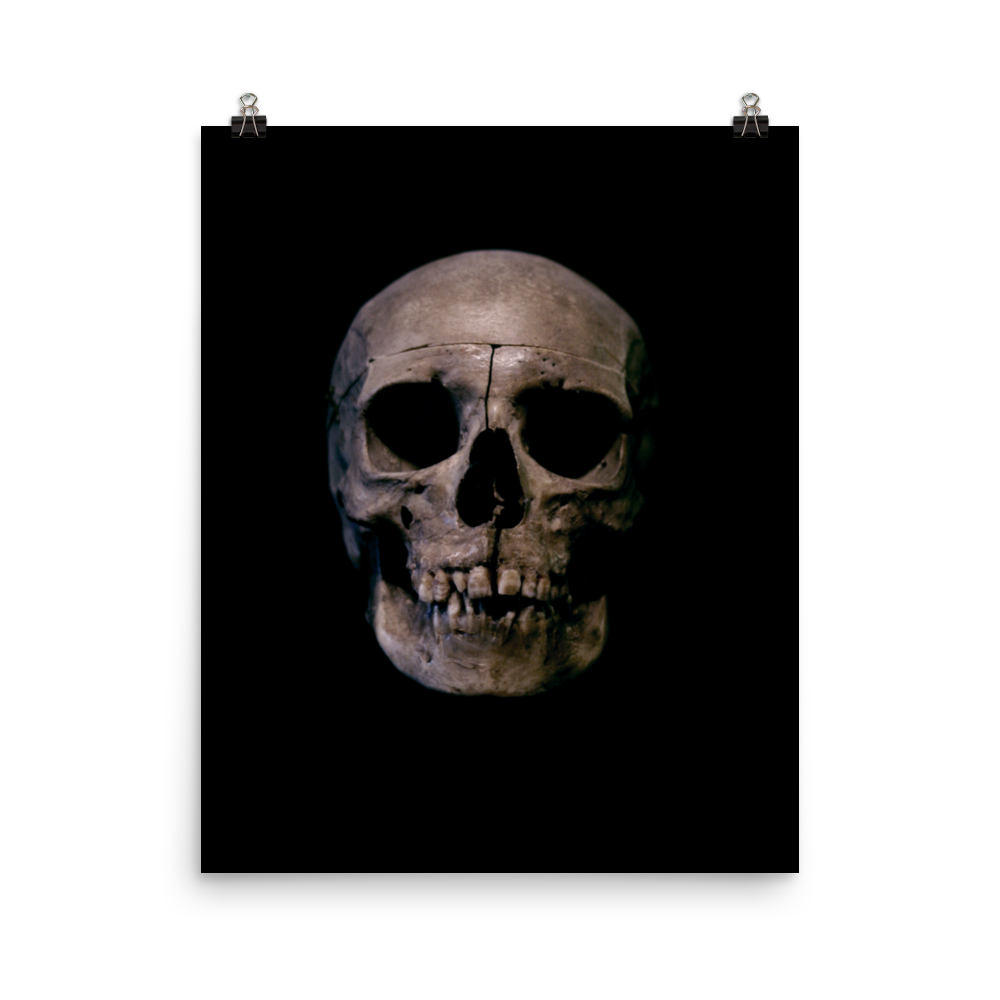 Human skull medical specimen front view - Art print