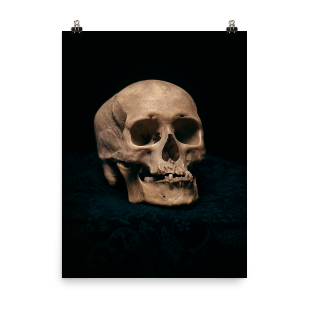 Skull with skewed jaw, real human skull photography - Art print