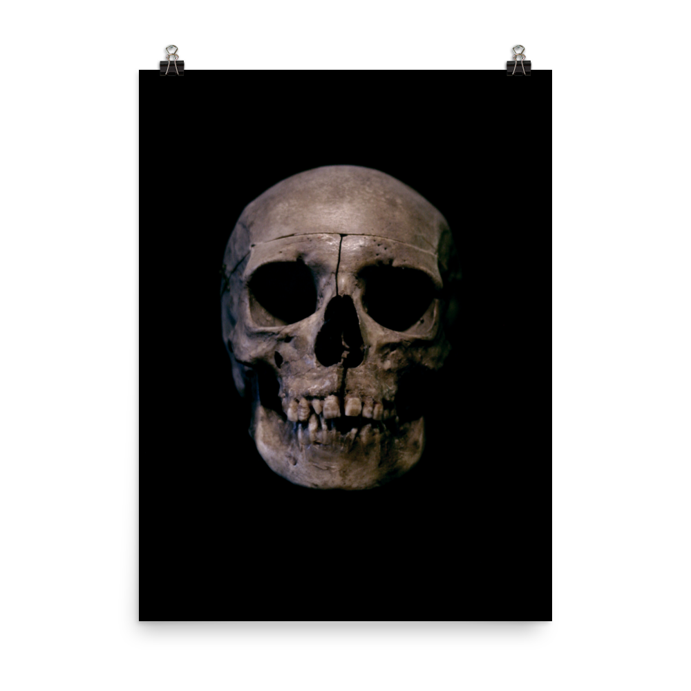 Human skull medical specimen front view - Art print