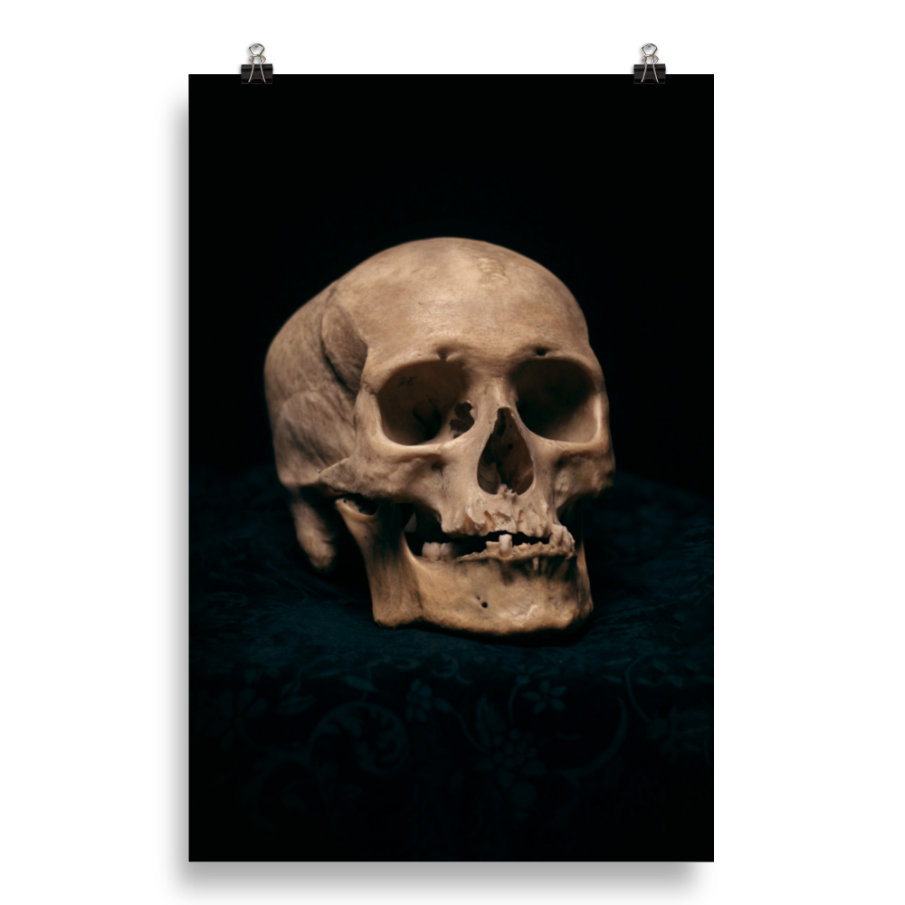 Skull with skewed jaw, real human skull photography - Art print