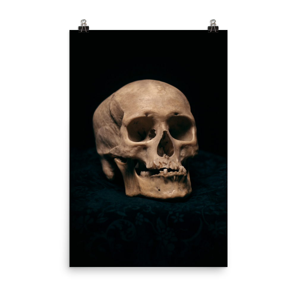 Skull with skewed jaw, real human skull photography - Art print