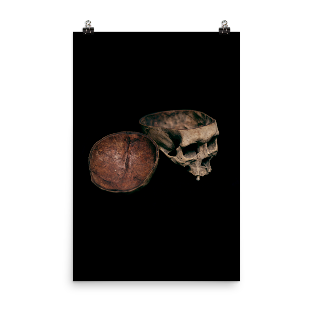 Skull with cut calvarium, real human skull photography - Art print