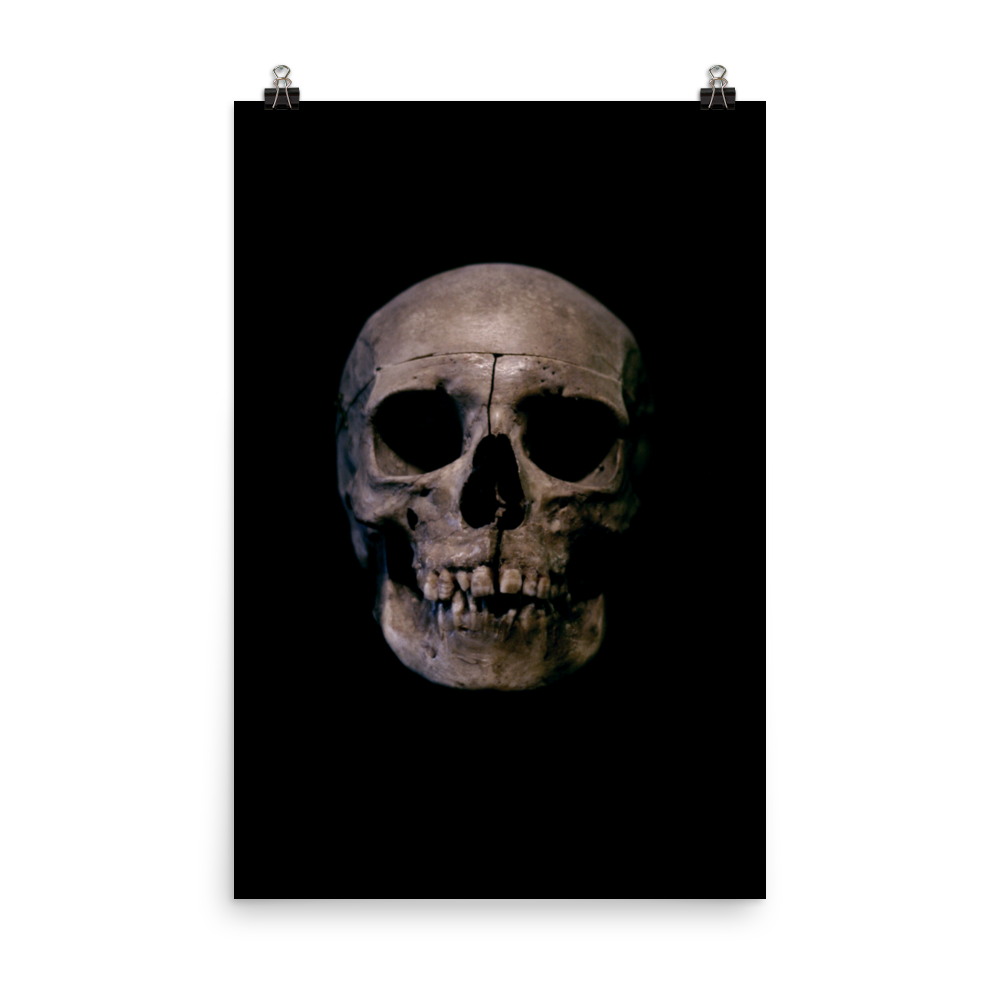 Human skull medical specimen front view - Art print