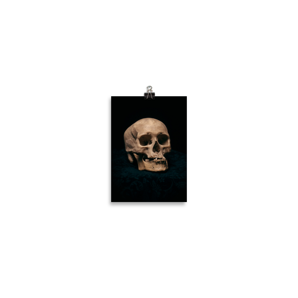 Skull with skewed jaw, real human skull photography - Art print