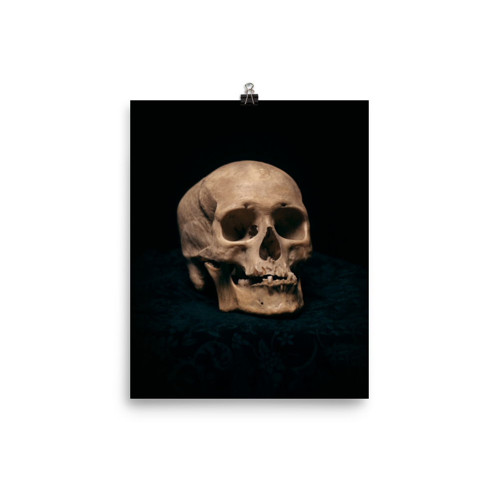 Skull with skewed jaw, real human skull photography - Art print