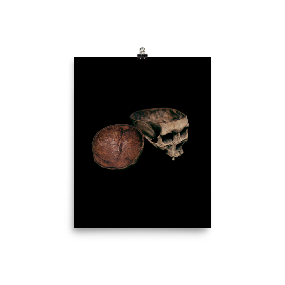 Skull with cut calvarium, real human skull photography - Art print