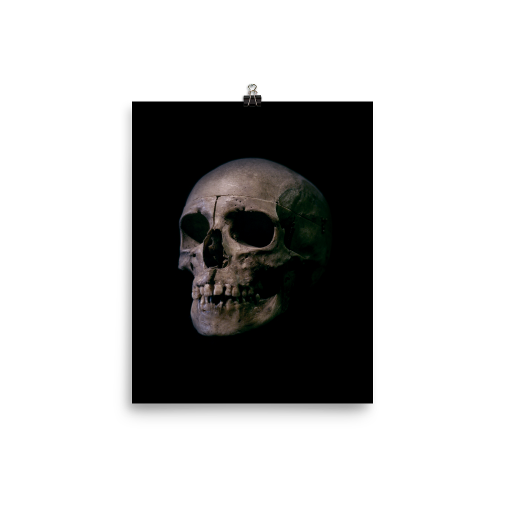 Human skull medical specimen side view - Art print