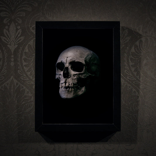 Human skull medical specimen side view - Framed poster