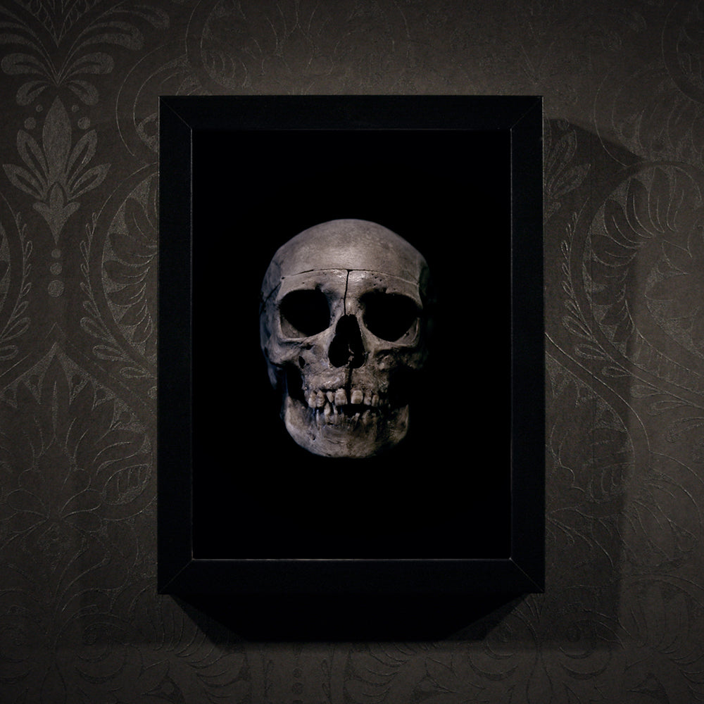 Human skull medical specimen front view - Framed poster