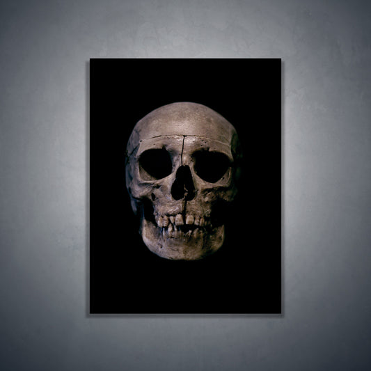 Human skull medical specimen front view - Art print