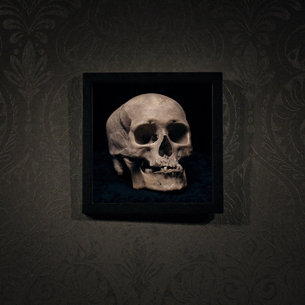 Skull with skewed jaw, real human skull photography - Framed poster