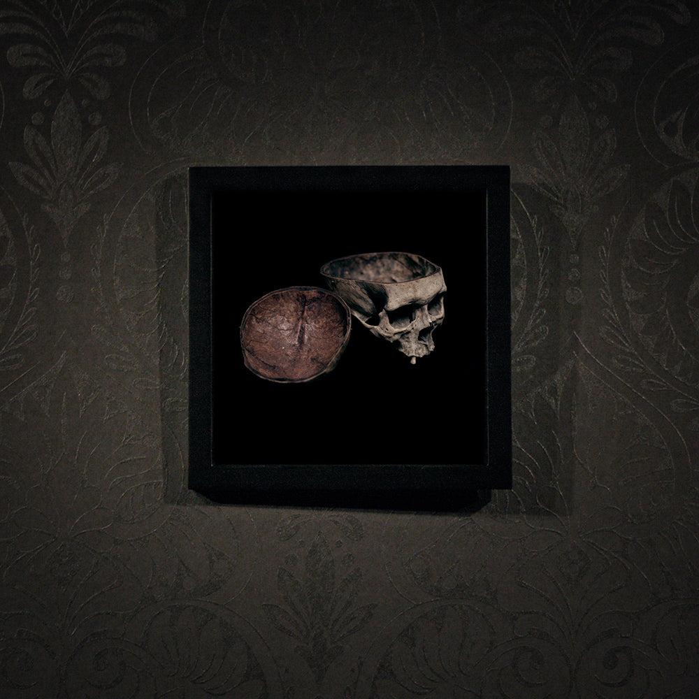 Skull with cut calvarium, real human skull photography - Framed poster