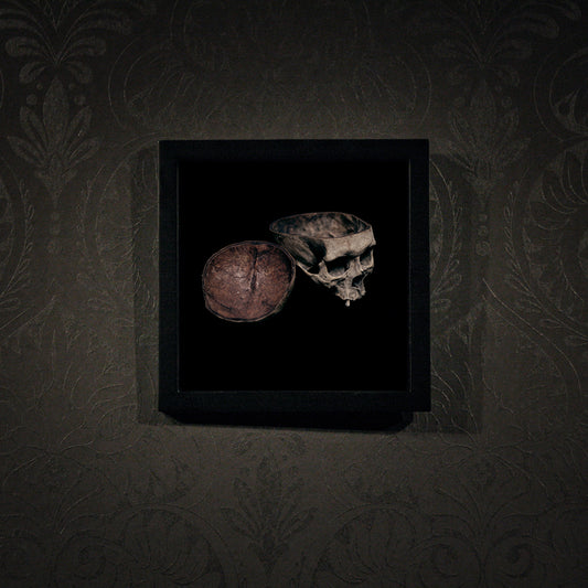 Skull with cut calvarium, real human skull photography - Framed poster