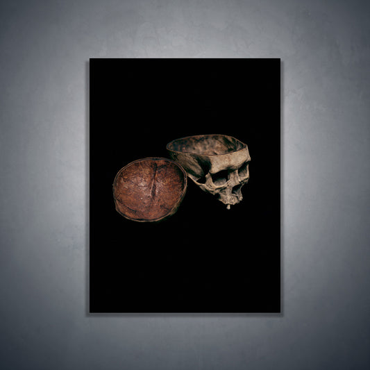 Skull with cut calvarium, real human skull photography - Art print