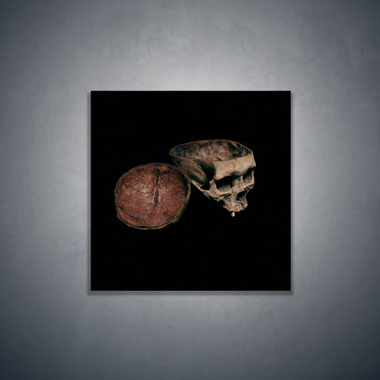 Skull with cut calvarium, real human skull photography - Square art print