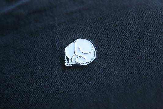 Fetal skull, dead fetus - PIN