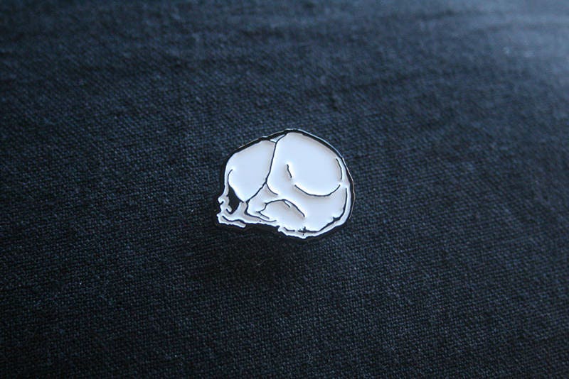 Fetal skull, dead fetus - PIN