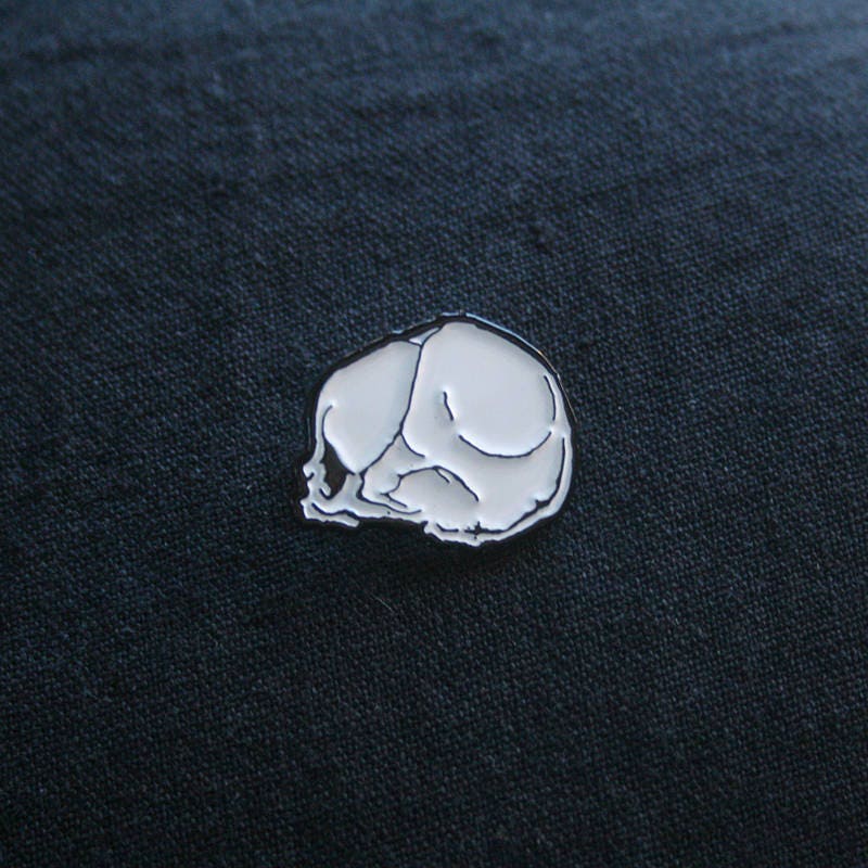 Fetal skull, dead fetus - PIN