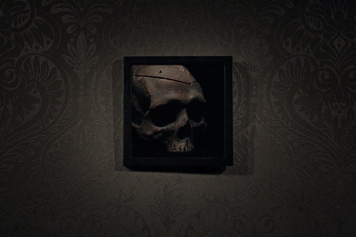 Skull medical cut with patina, framed in black frame - Art print