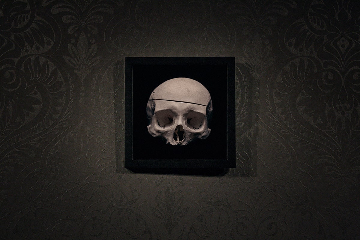 Skull medically prepared, framed in black frame - Art print
